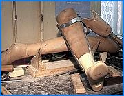 ></p><p class=c_tn>В Ивановской области возник дефицит протезов - всех, кроме зубных. Единственное в регионе протезно-ортопедическое предприятие объявило о временной приостановке своей работы. Указанная причина - прекращение финансирования со стороны фонда социального страхования. Заявленный срок окончания вынужденного простоя – 29 сентября. Однако дата - неокончательная. </p><p class=c_tn>Владимир Реональдович Афанасьев - бывший шахтер. 21 год на копях Воркуты закалил его и сделал оптимистом. Когда в 2004 году после осложненного тромбоза ему ампутировали правую ногу, он не сдался. Тем более что государство оказало всяческую поддержку. Особенно он благодарен врачам и протезистам Ивановского ортопедического центра. В руках Владимира - его первый, учебный, протез, сделанный именно там. Когда он услышал о проблемах предприятия - это его в буквальном смысле слова задело за живое. Протезы нужно регулярно менять, так как культя со временем меняет форму.</p><p class=c_tn>Но теперь возможности получить или отремонтировать протез нет у сотен инвалидов области. Единственное в регионе предприятие, где налажено массовое производство протезов и ортопедических изделий, встало. Вот это объявление сообщает о временной остановке работы в связи с прекращением финансирования со стороны соцстраха.  Фонд прекратил выписывать направления на протезирование и оплачивать уже изготовленные протезы. В  худшей ситуации оказались люди, ставшие инвалидами совсем недавно. Они вынуждены сидеть дома, не выходить на улицу, потому что нет  возможности изготавливать первый в их жизни учебный протез.</p><p class=c_tn>Каждое новое поколение протезов - это шаг вперед. Поэтому, остановив предприятия - это шаг назад для инвалидов, которые не могут получить новые модели. Директор предприятия Юрий Пучков с гордостью показывает образцы. Немецкие и отечественные, сделанные на космическом НПО Энергия. Стоимость колеблется в районе 1-2 тысяч долларов.  Раздавать их себе в убыток никто не собирается. Тем более, существует государственный контракт, по которому соцстрах обязался оплачивать протезы.</p><p class=c_tn>Как сказал директор протезно-ортопедического предприятия Юрий Пучков - «в фонде социального страхования все деньги отданы. Но если в прошлом году было потрачено около 24 млн., то в этом году - всего лишь 14 млн. выделено на это дело. Переписка с фондом к значимым результатам не привела. Единственный итог - удивление и недоумение».</p><p class=c_tn>В окончательной бумаге от заместителя председателя фонда социального страхования Российской Федерации есть примечательная выдержка: «предлагаем вам рассмотреть вопрос об изыскании возможности по снижению цен на изготавливаемые протезно-ортопедические изделия за счет пересмотра накладных расходов и предельного уровня рентабельности». В переводе с чиновничьего языка это может означать, что ортопедам предлагают перейти на производство протезов времен японской войны и работать без прибыли. Сейчас у предприятия есть надежда на реакцию государственной думы, куда тоже направлено обращение, - подобные проблемы испытывает не только наша губерния. Либо свои деньги предприятие  будет требовать через суд.</p><p class=c_tn> </p><p class=c_av>Сергей Хохлов</p>
	
		<div class=