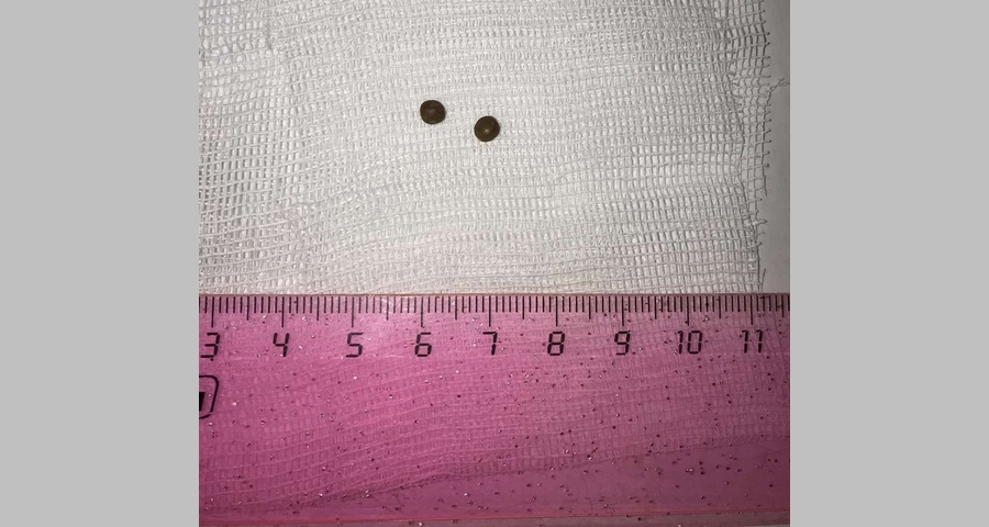 mx-bL4E3L9YLURKrEAaFRgcU-0MwIi3b9Sze_hMkJOMUhc18ioLYDgVomo5fyND1tANQSAWhg1OkdKFeXKQAKbl1.jpg mx-bL4E3L9YLURKrEAaFRgcU-0MwIi3b9Sze_hMkJOMUhc18ioLYDgVomo5fyND1tANQSAWhg1OkdKFeXKQAKbl1.jpg