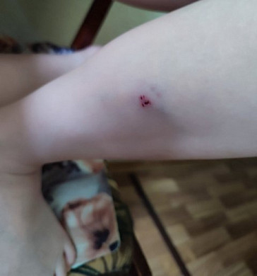 В Иванове домашняя собака укусила на улице ребенка