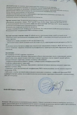  Многодетную маму из Иванова лечили от гайморита, а у неё оказалась лимфома 