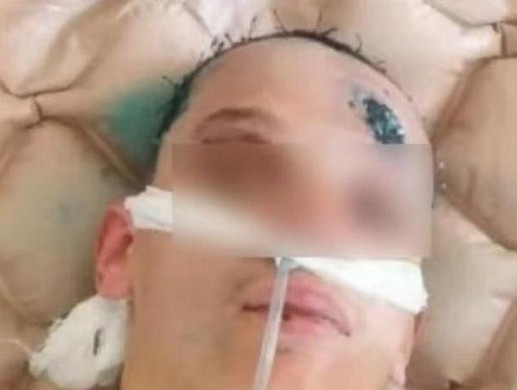 В Иванове полиция возбудила уголовное дело по факту истязания человека