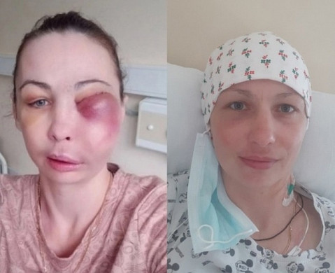 Многодетная мама Олеся из Иванова победила рак