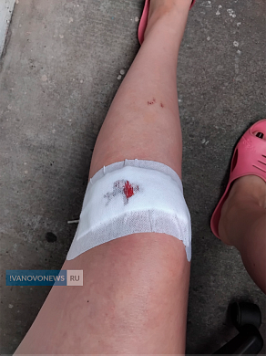 В Иванове велосипедистка упала с резко оборвавшегося тротуара и порвала колено