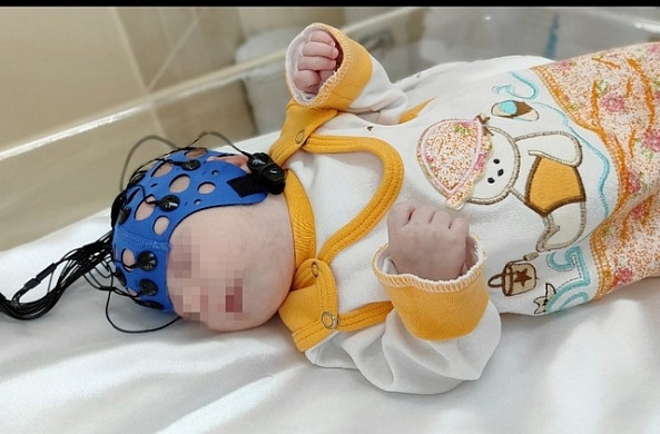 В ивановском роддоме №1 появилось оборудование для нейромониторинга новорожденных 