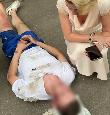 Директор ивановского депздрава оказала помощь парню, упавшему с самоката