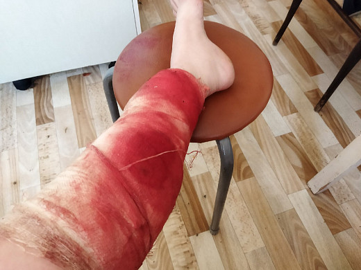 В Ивановской области собака едва не загрызла женщину 