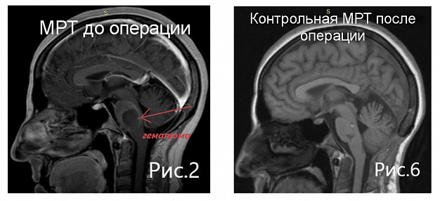  В Иванове нейрохирург областной больницы удостоен премии «Милосердие» 