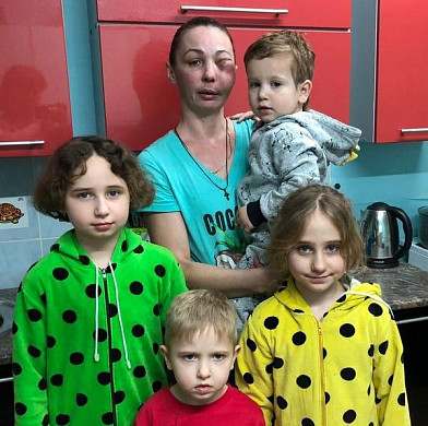  Многодетную маму из Иванова лечили от гайморита, а у неё оказалась лимфома 