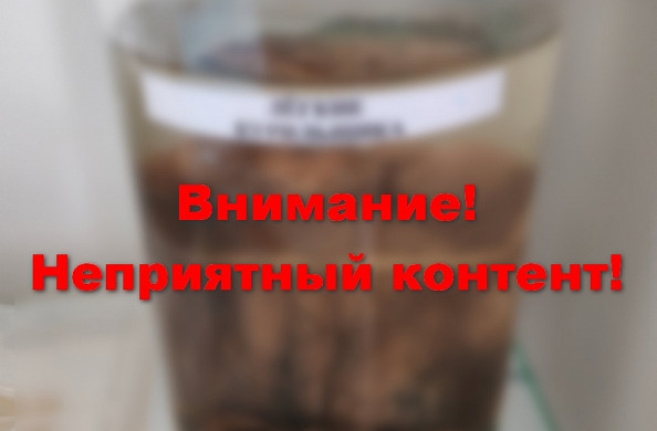  Ивановское бюро судмедэкспертизы подарило юридическому колледжу легкие курильщика 