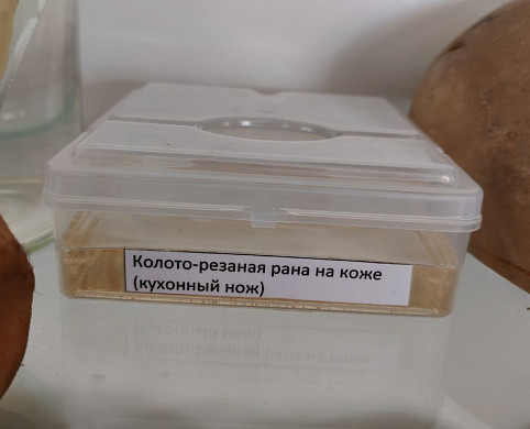  Ивановское бюро судмедэкспертизы подарило юридическому колледжу легкие курильщика 